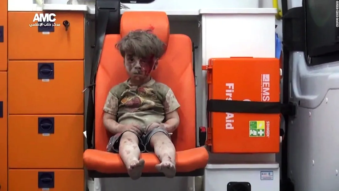 The photo of Omran Daqneesh that went viral. Credit: Aleppo Media Center