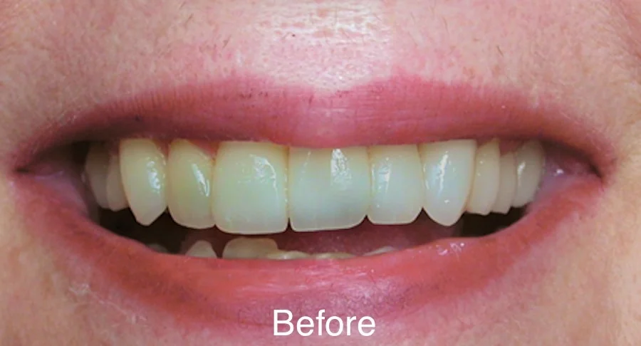 Case 1_Before text.jpeg