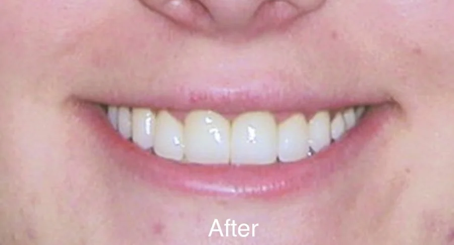 Case 5_After text.jpeg