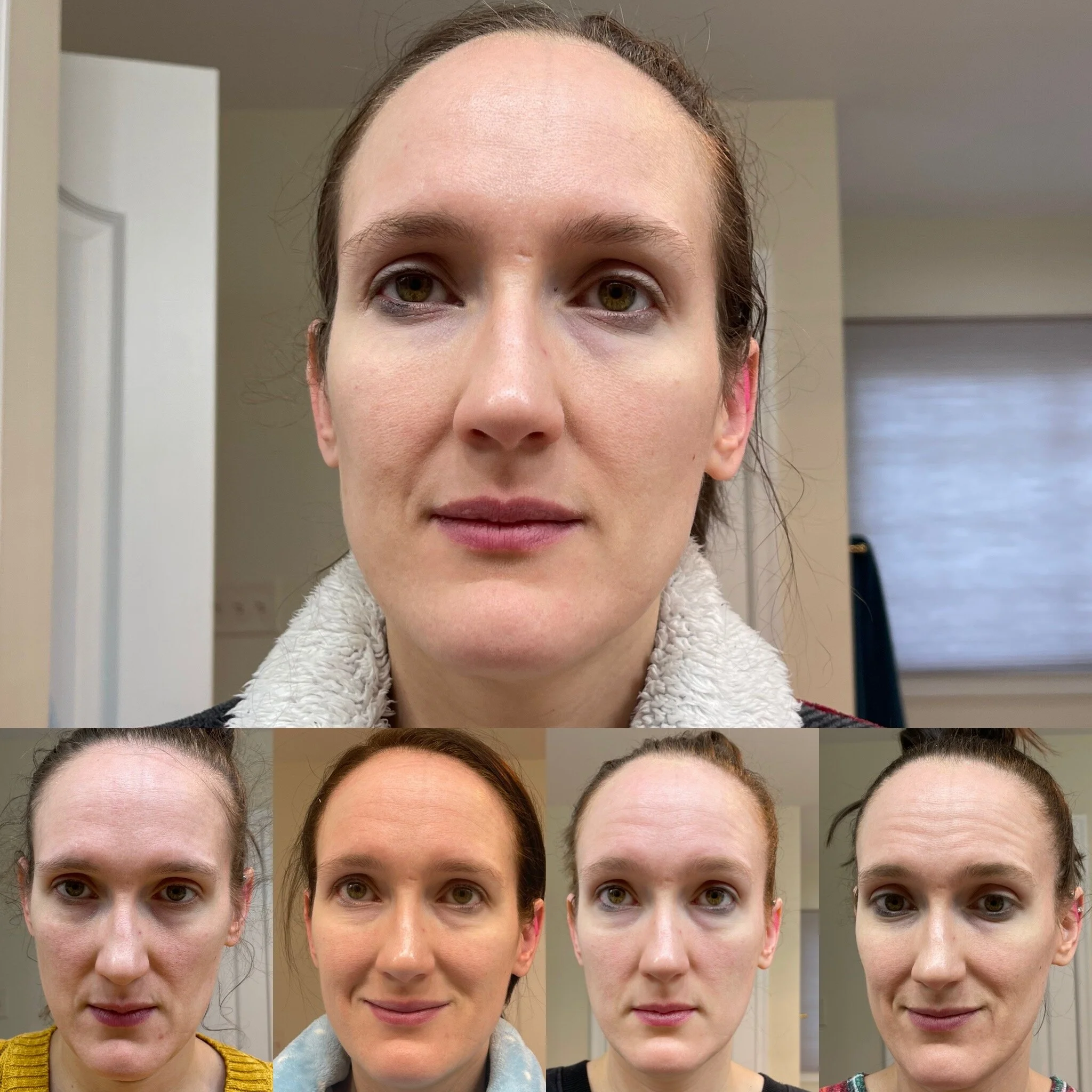 Review Peter Thomas Roth PRO Strength 10 PHA Exfoliating Clarifying Liquid — Girl Wonder Life