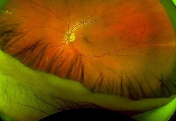 Do you see what I see? #29