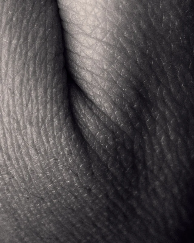 skin 1