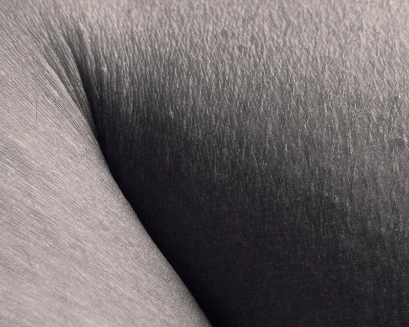 skin 3