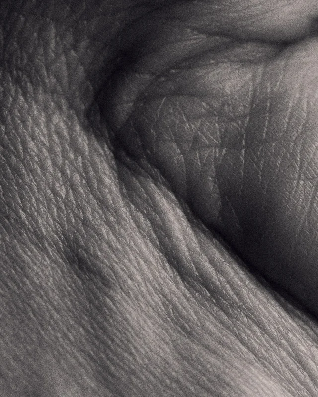 skin 6