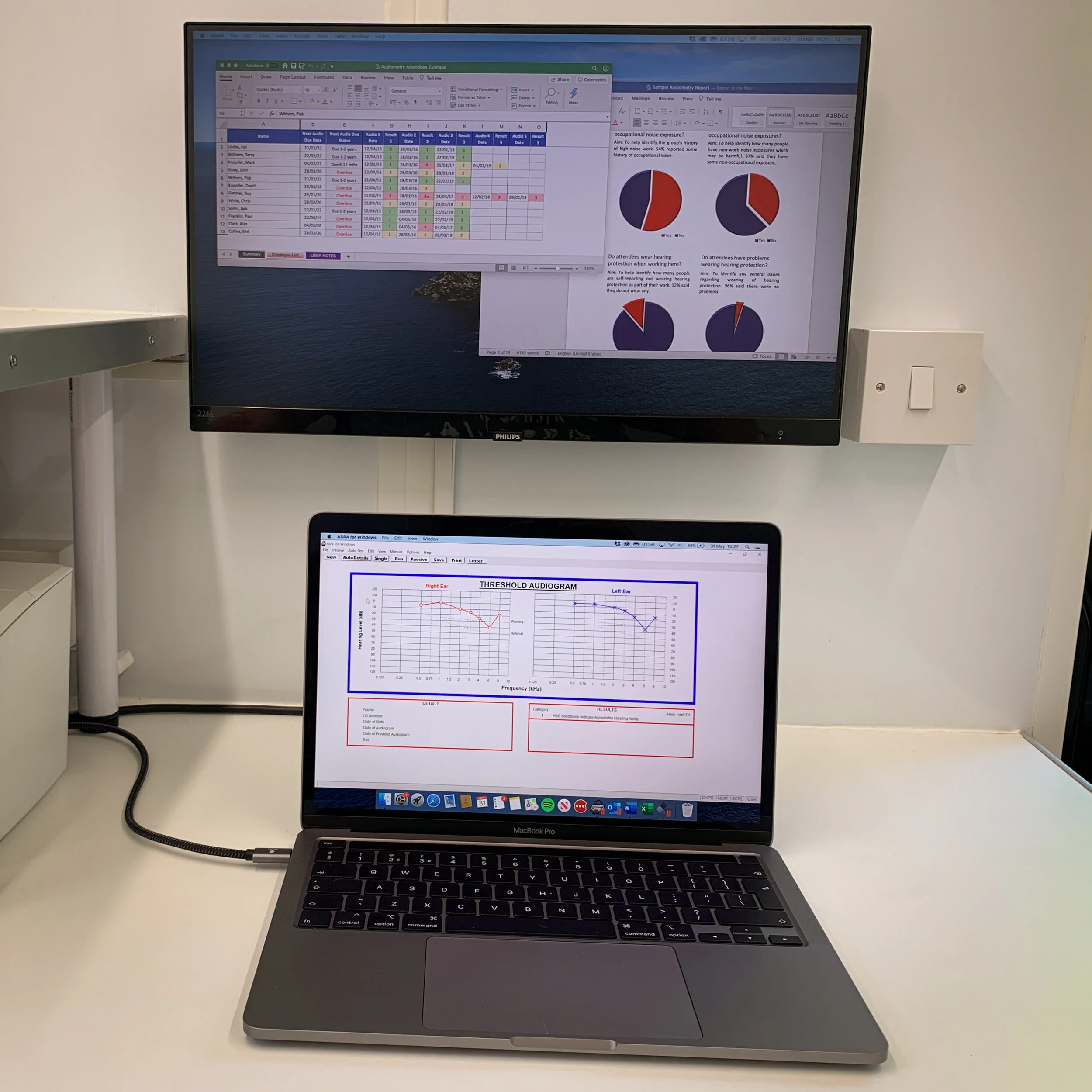 Audiometric Testing Mobile Occupational Screening Audiometry