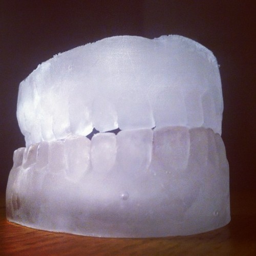 Frozen smile.
