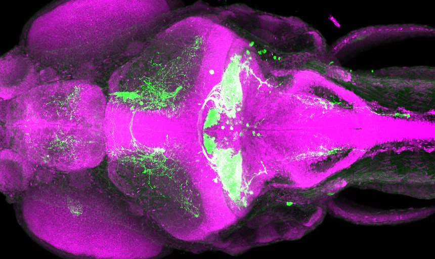 Will's paper on Restless Legs Syndrome published in Current Biology