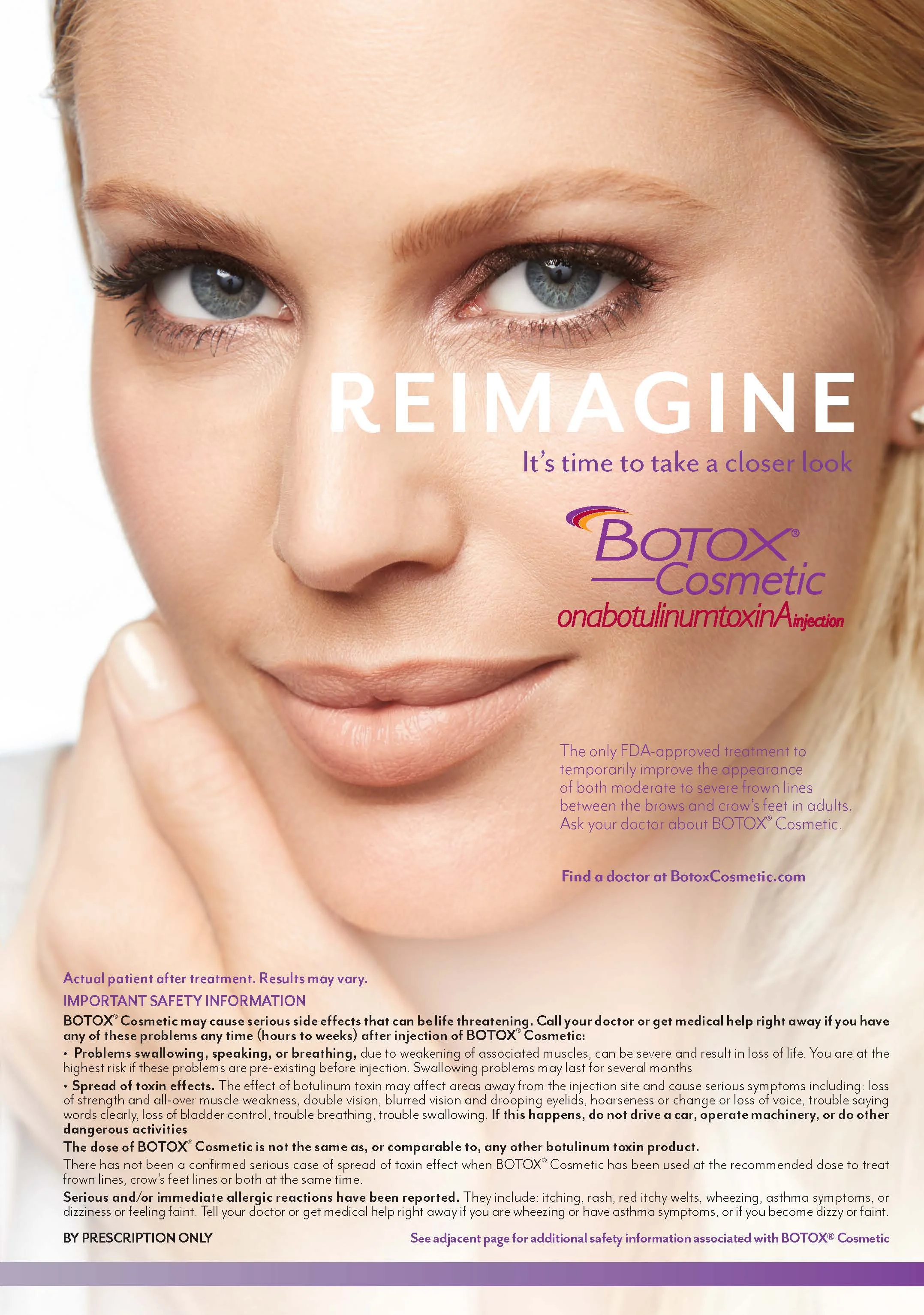 Botox_278_275_ALT.jpg