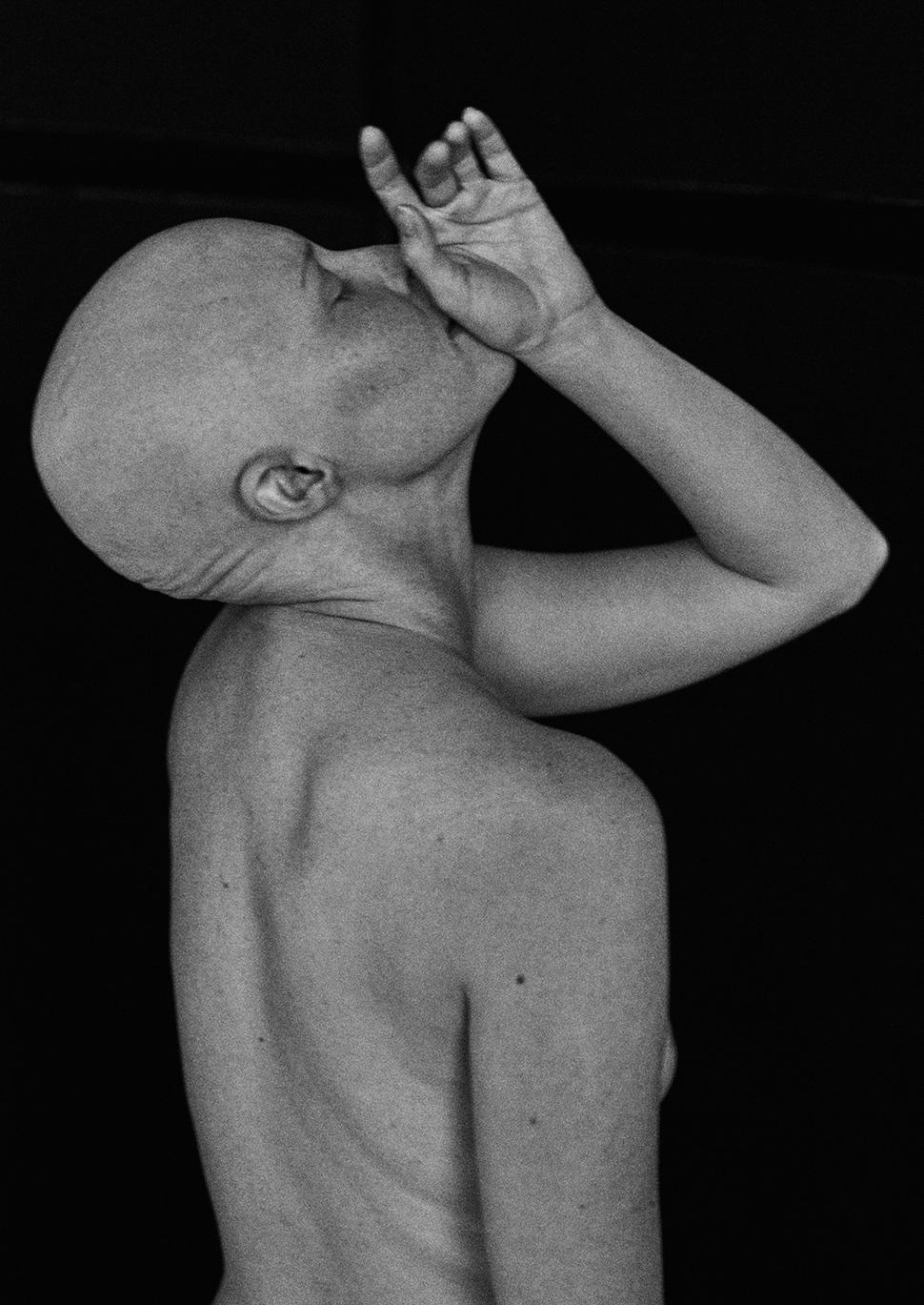 ©Andres Hernandez 2015 Shot in the middle of chemo. 