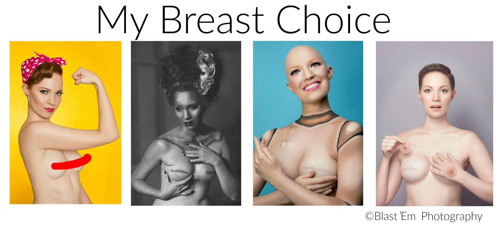 Mastectomy Photo Series Bride Of Frankenstein Aniela My Breast Choice