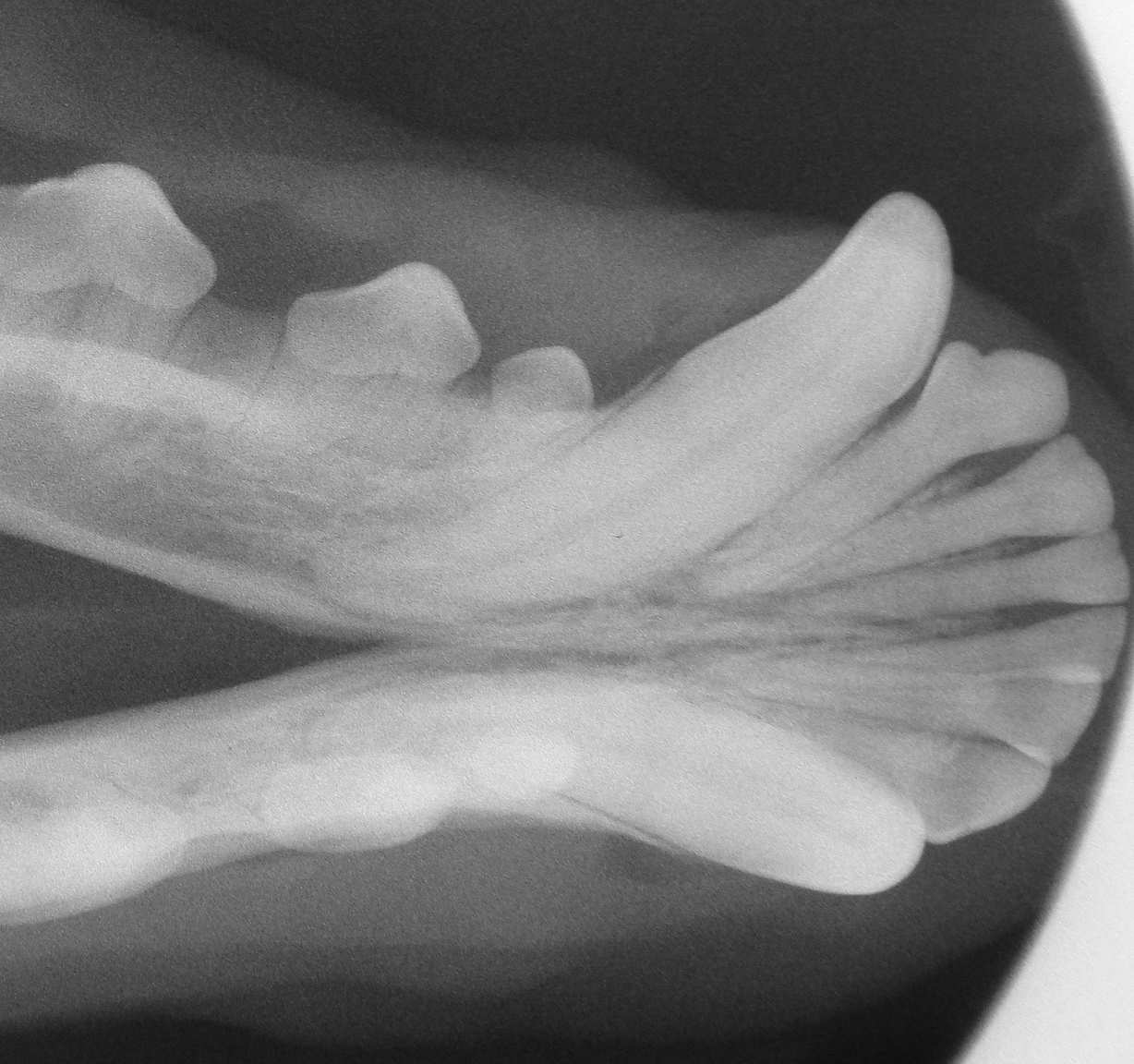 Dental Radiograph 1.jpg