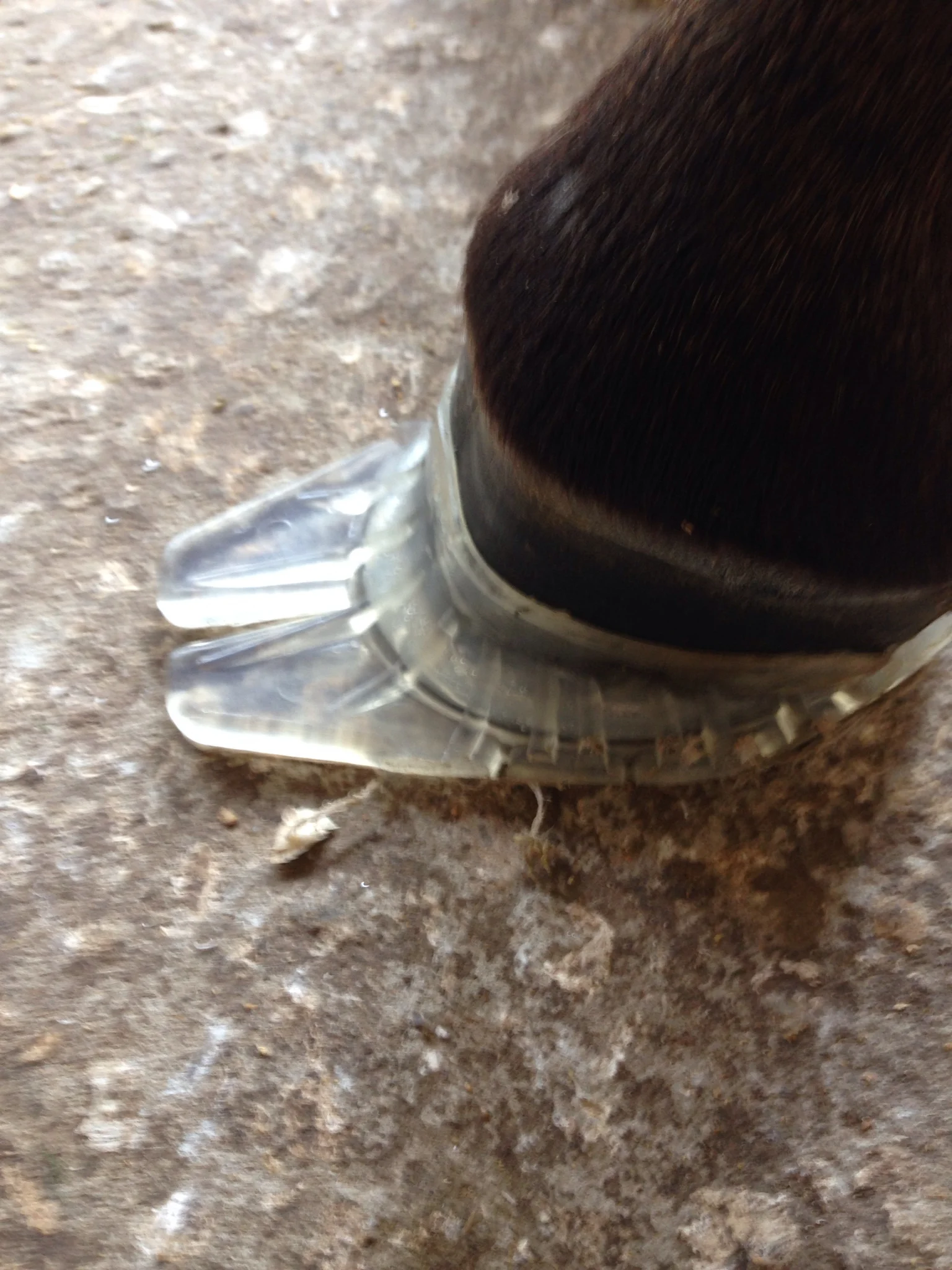 Kevin Peaden's Dalric cuff/club foot case study