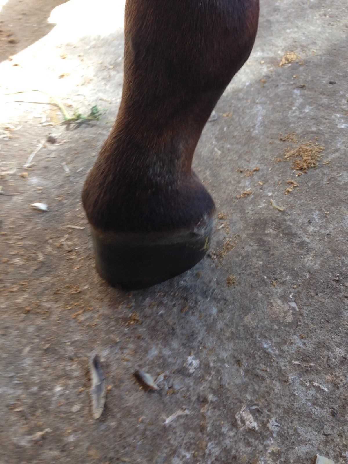 Kevin Peaden's Dalric cuff/club foot case study