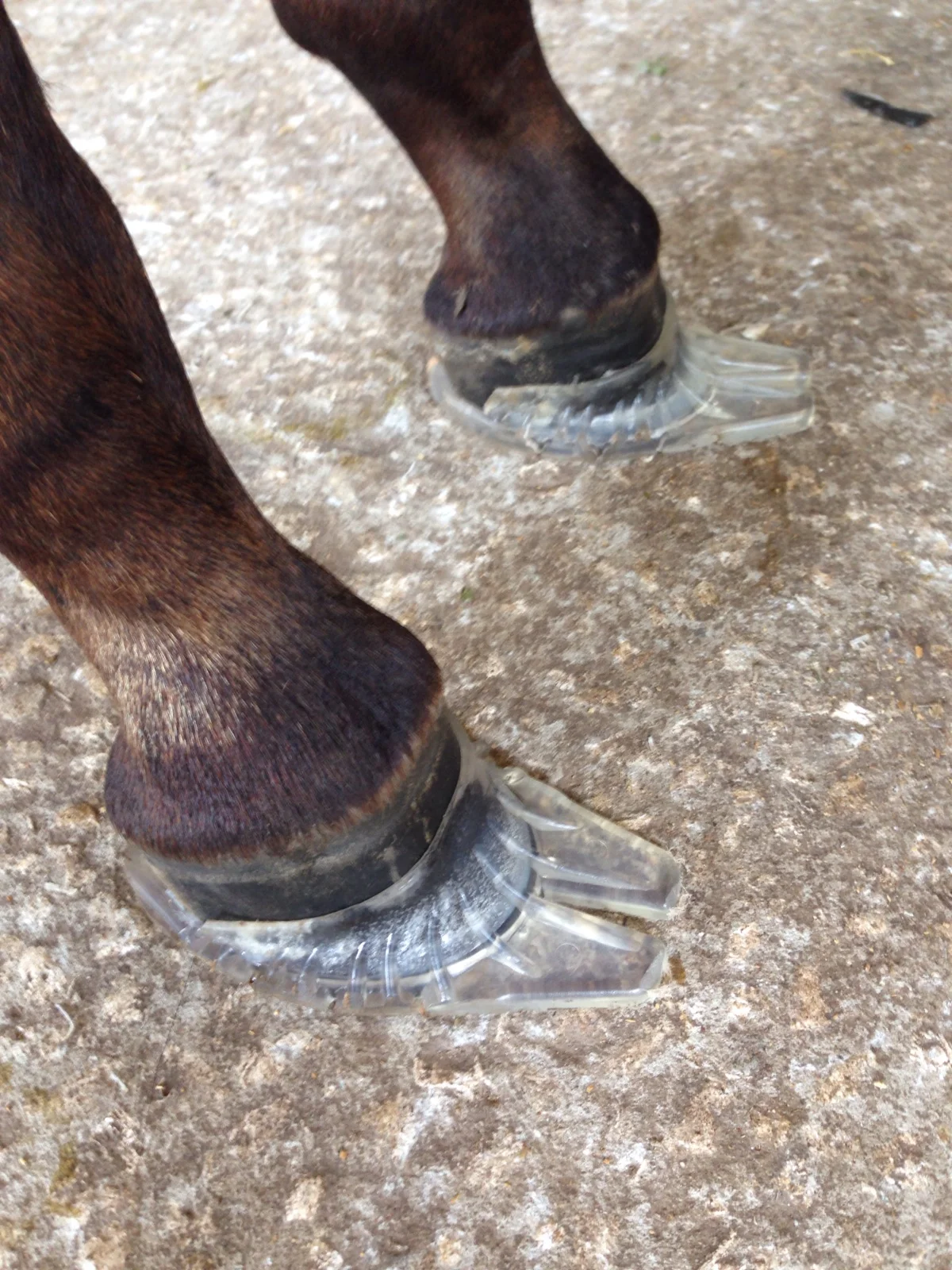 Kevin Peaden's Dalric cuff/club foot case study