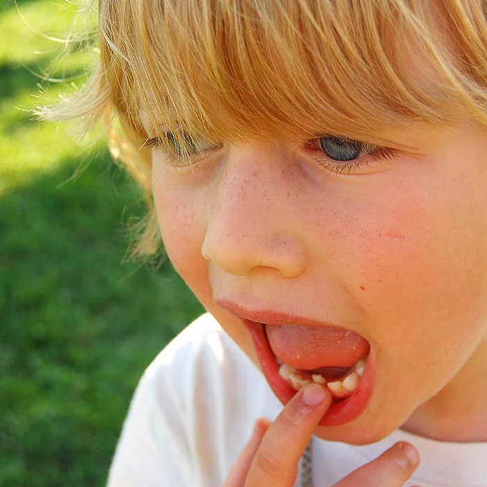 Your Child's First Loose Tooth