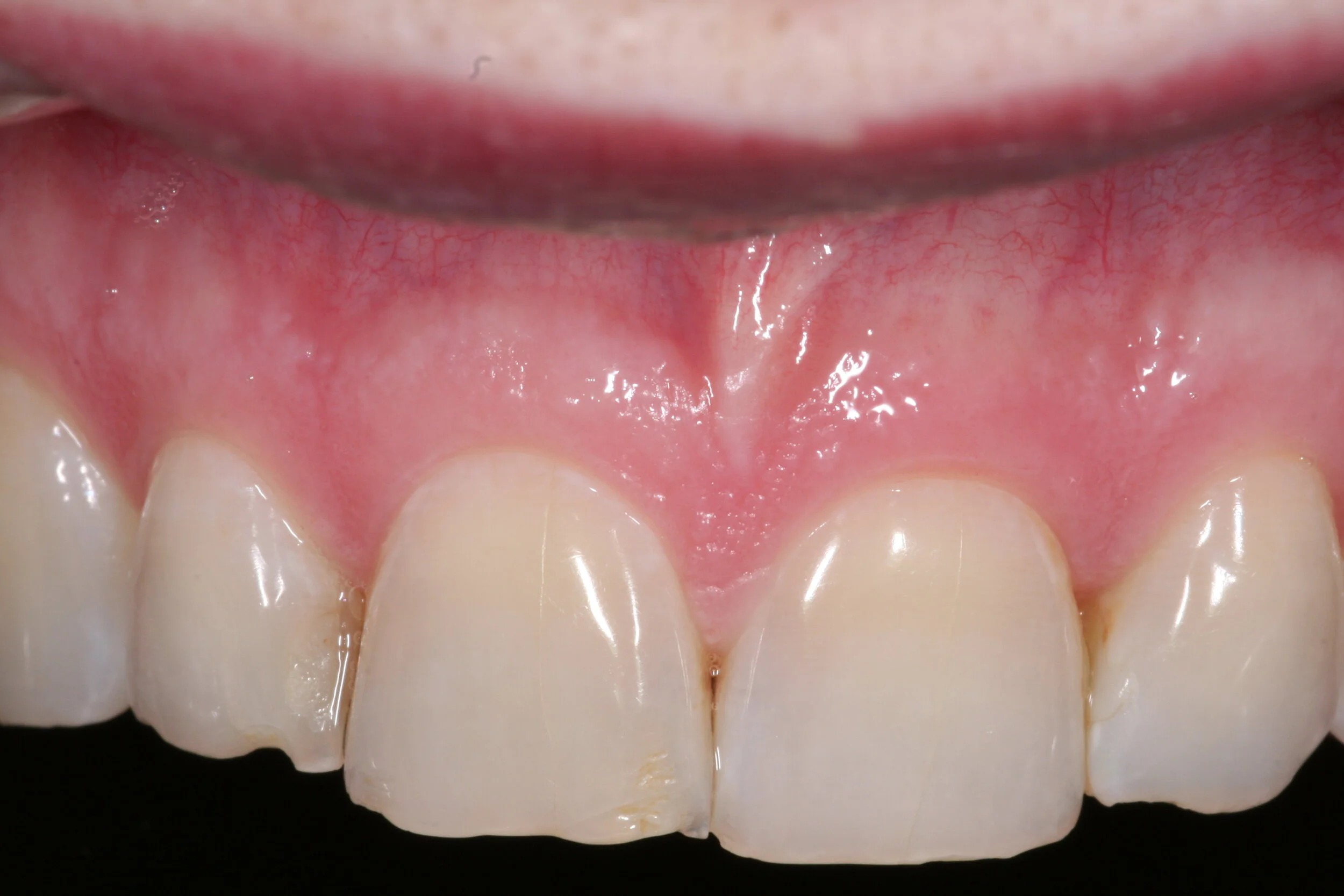 allen intraoral 007.jpg