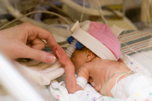 "NICU" by Lisa Ludden