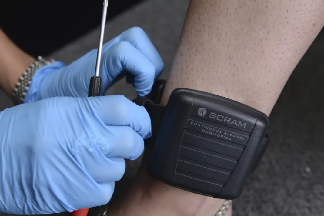 Bridget Gainer: Ankle monitors for DUI, traffic cases are creating private profit with little transparency