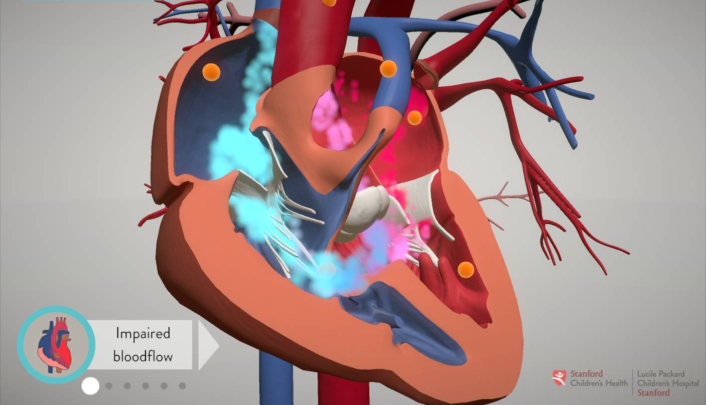 Defective Heart