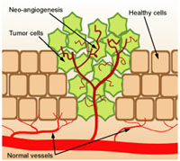 angiogenesis.jpg