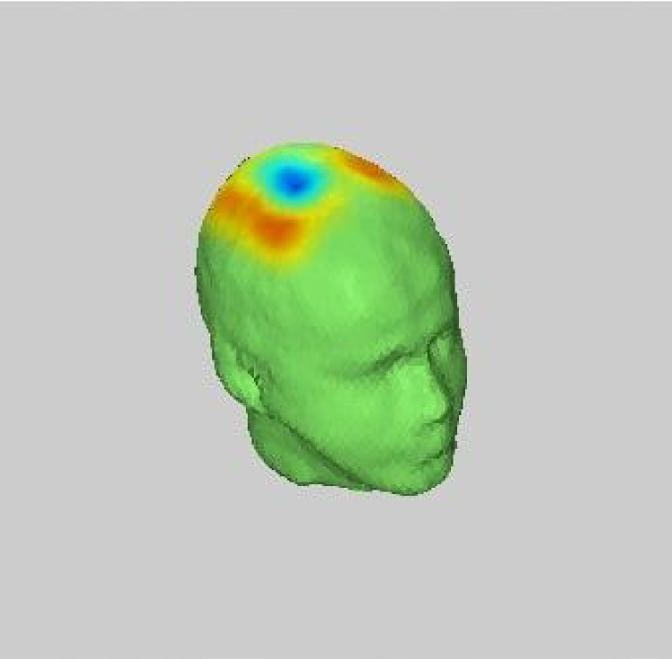 NIRS NIRStar Head Model with Activation.png