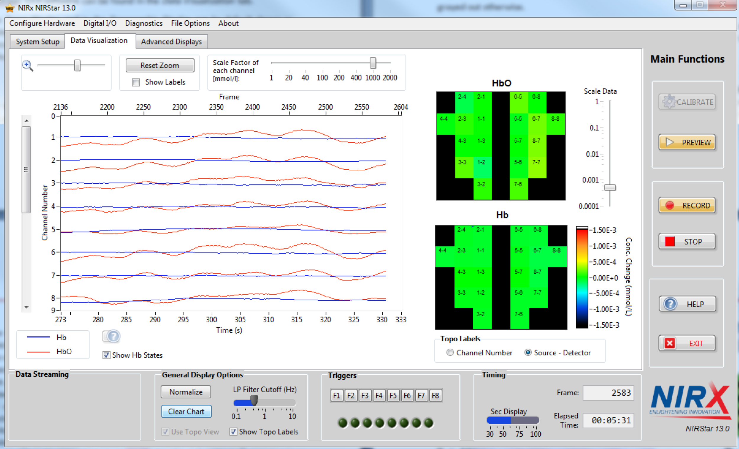 NIRS NIRStar Topomaps and data viewer.png