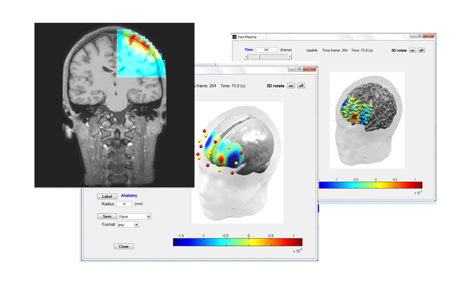 fNIRS Software NIRS Analysis NIRS Data Recording fNIRS Systems