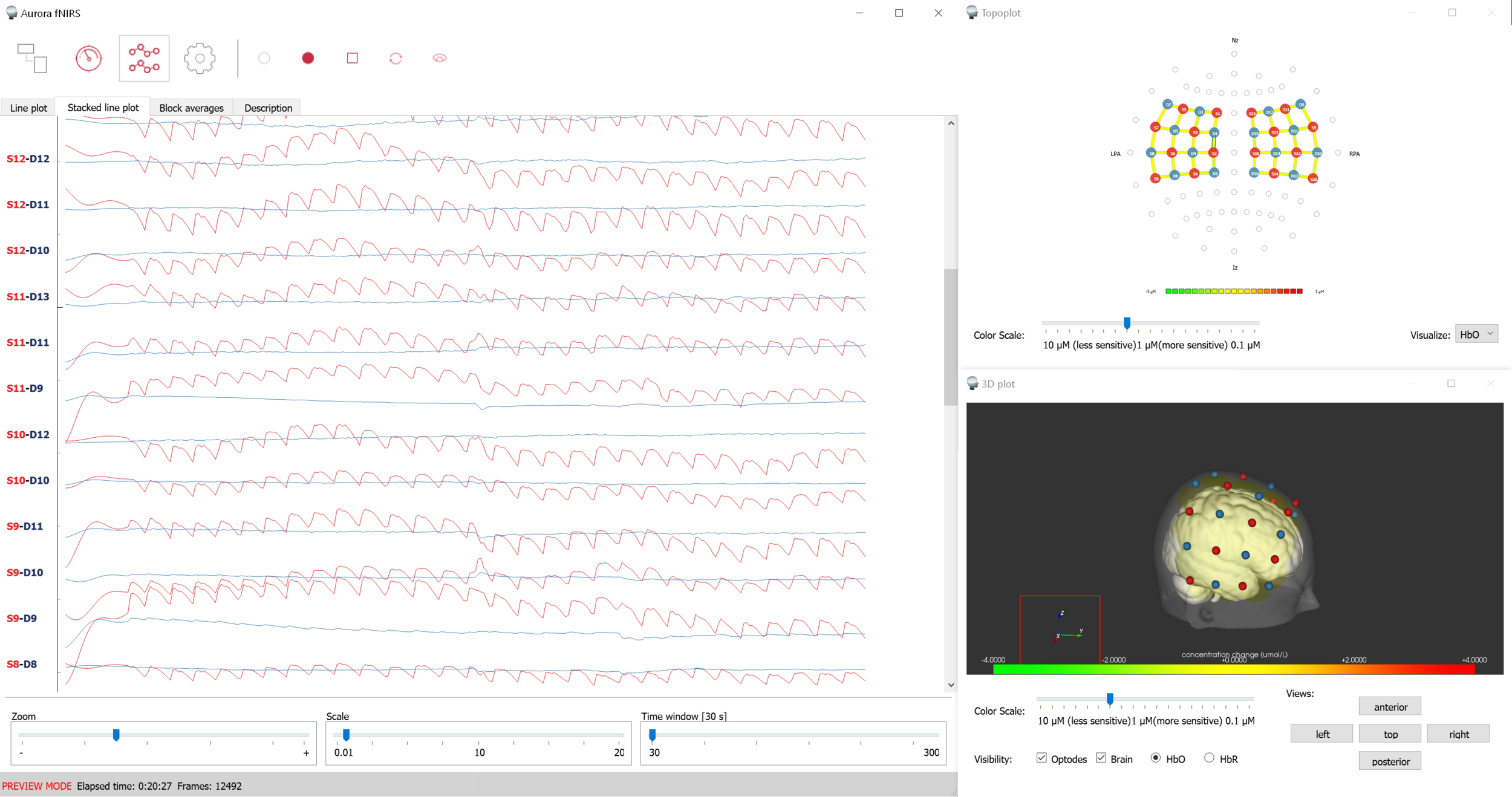 fNIRS Software NIRS Analysis NIRS Data Recording fNIRS Systems