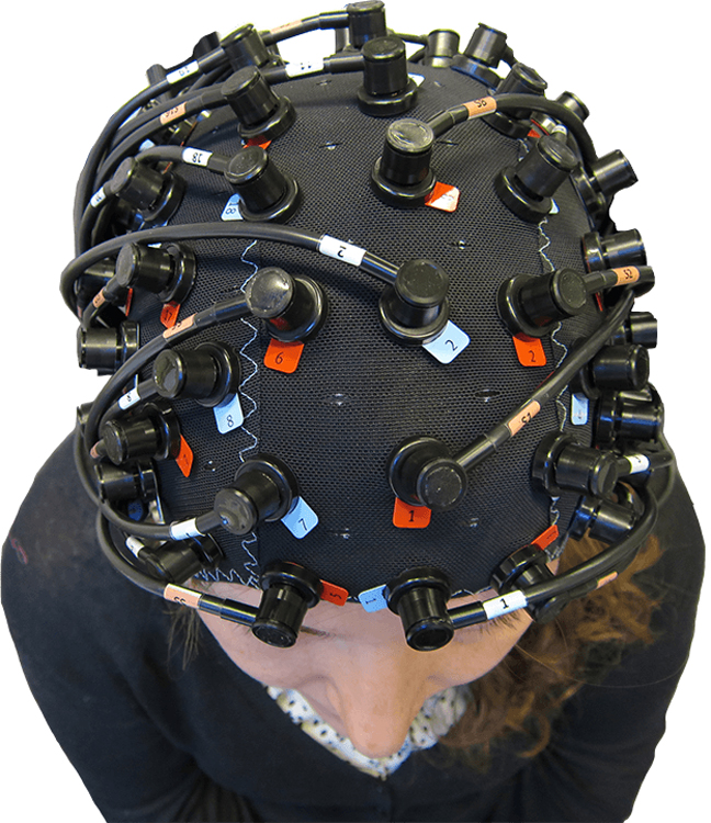 A whole-head NIRScap, measuring over 100+ channels of fNIRS data