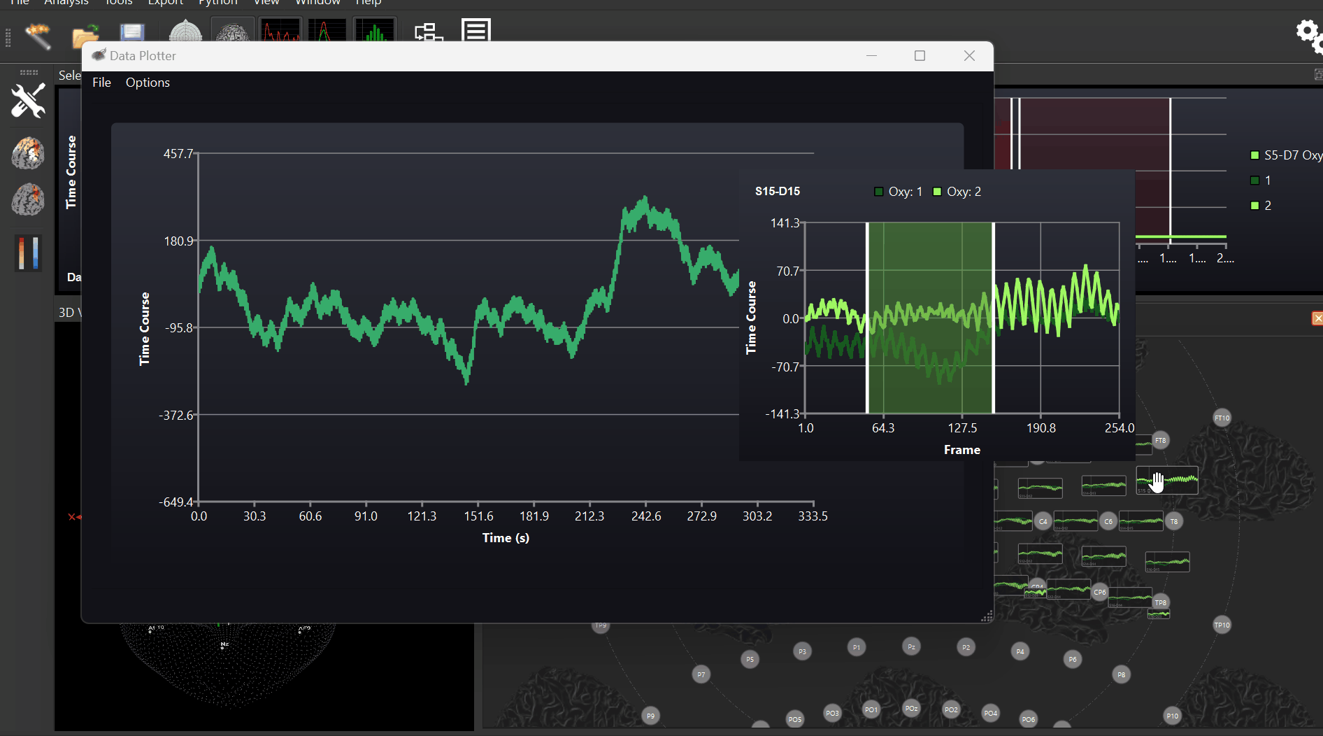 Blogcontent fNIRS Systems NIRS Devices NIRx
