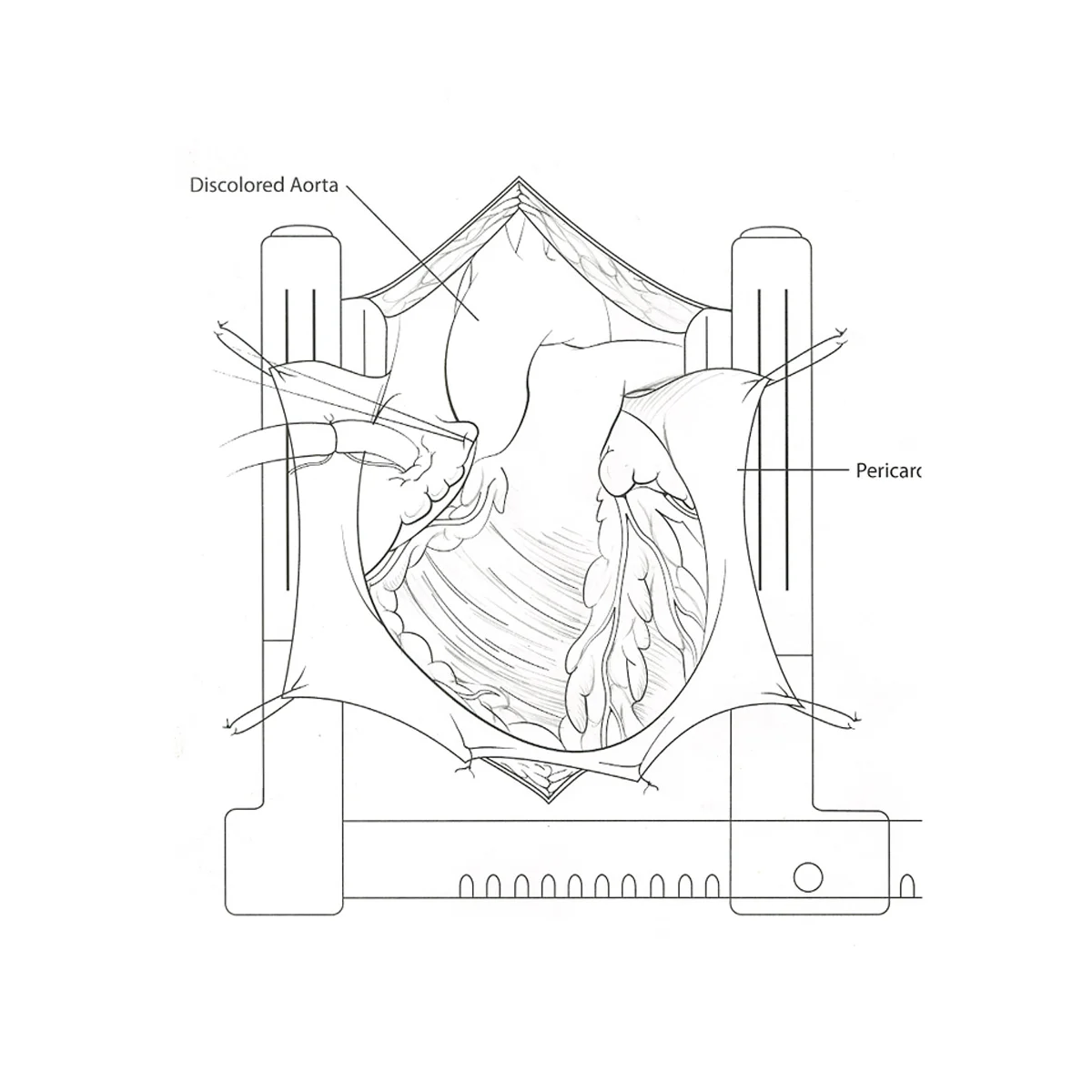  Step 2: (Concept Sketches)  Refined concept sketches with inclusion of suggested edits. 
