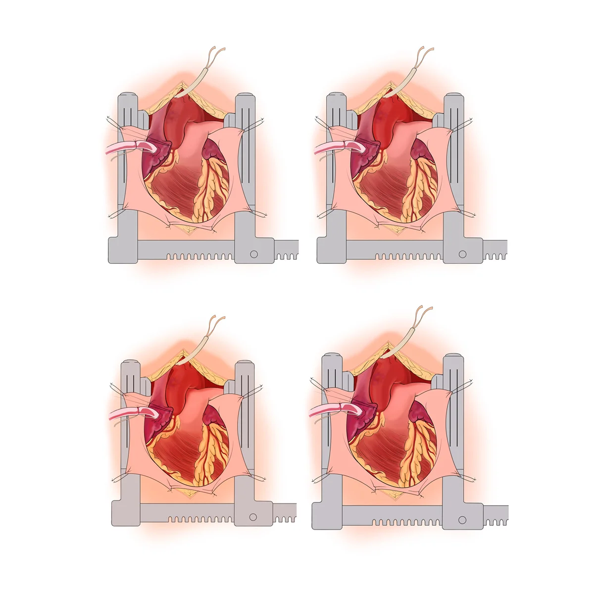  Step 4: (Flat Color Studies)  Exploration of color, light, and form. 