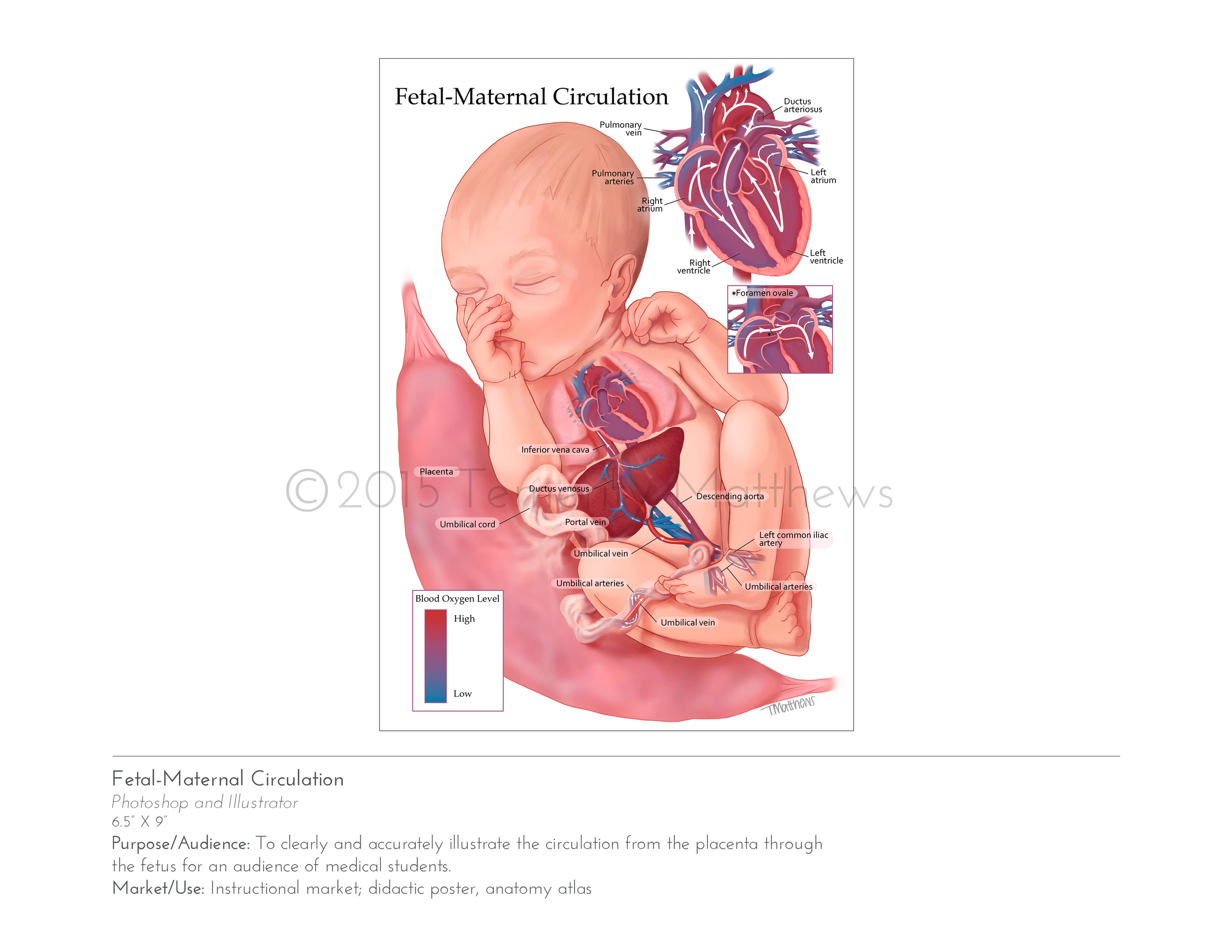 fetalmaternal.jpg