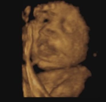 3D baby photo