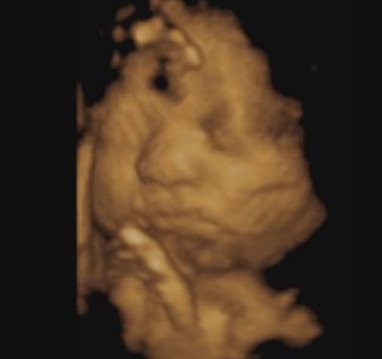 3D baby photo