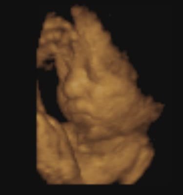 3D baby photo