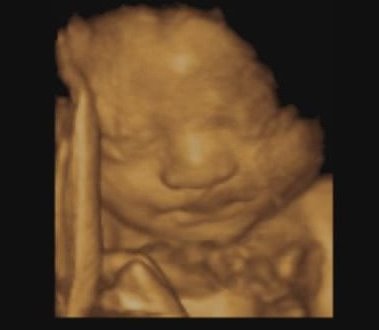 3D baby photo