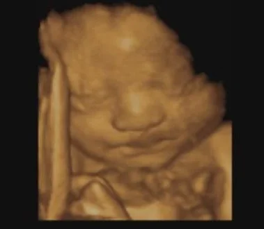 3D baby photo