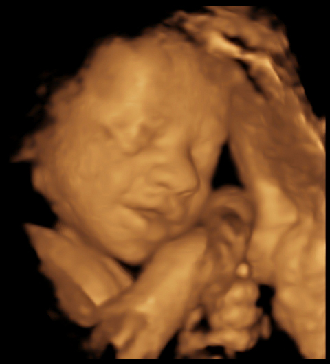 3D baby photo