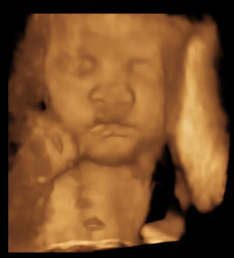 3D baby photo