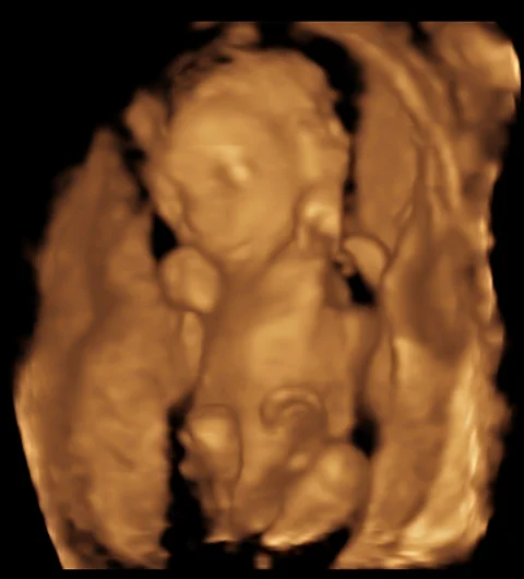 3D baby photo