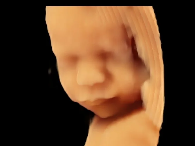 4D ultrasound Luminance