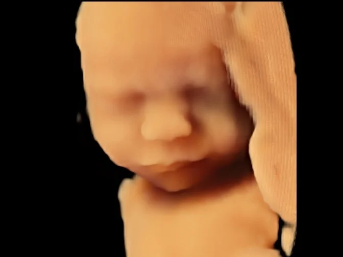 Amazing 3D ultrasound