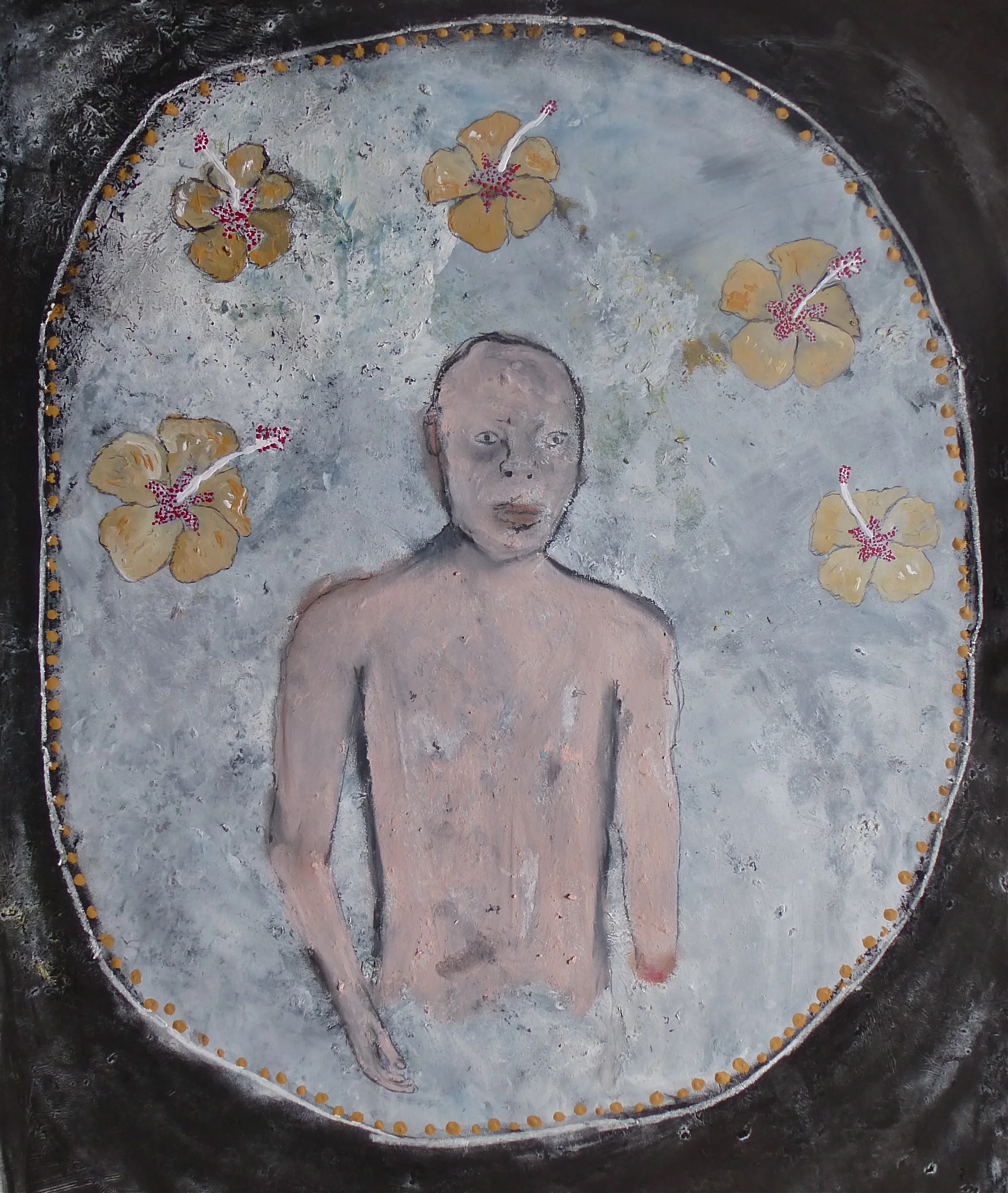  Tanzanian Albino  Acrylic on paper 45x61cm 