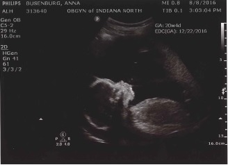 Our little kiddo at our 20 week check up/ultrasound