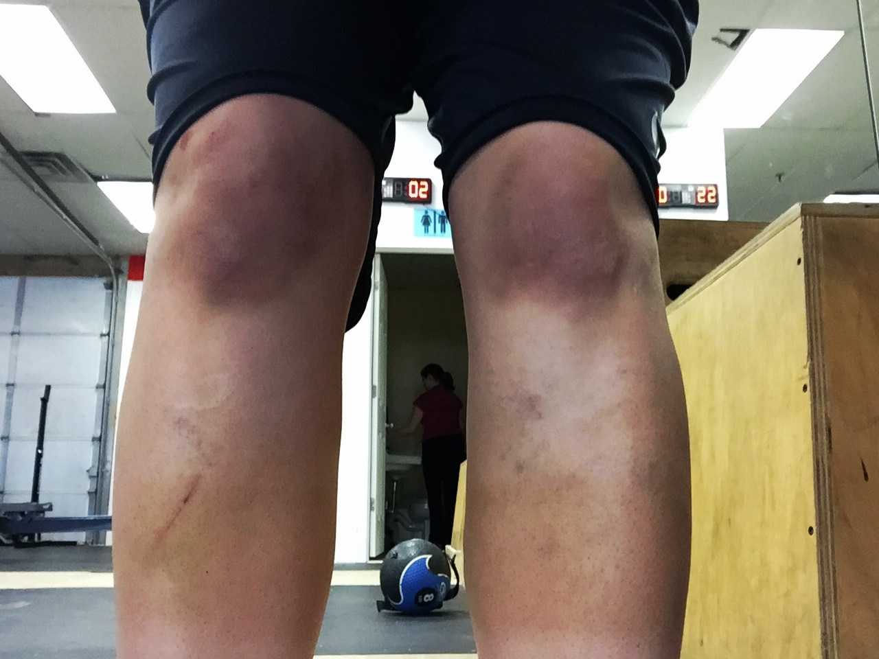 Old habits die hard. Those are current bruises on my knees; not old scars or old marks. Bruises. The science of habit tells me that my reaction to a volleyball (or walleyball) falling to the floor is so ingrained, that I can't stop myself from throwing myself after it. Thanks to my high school coach Cathy Gilkey for coaching us so well. I think...