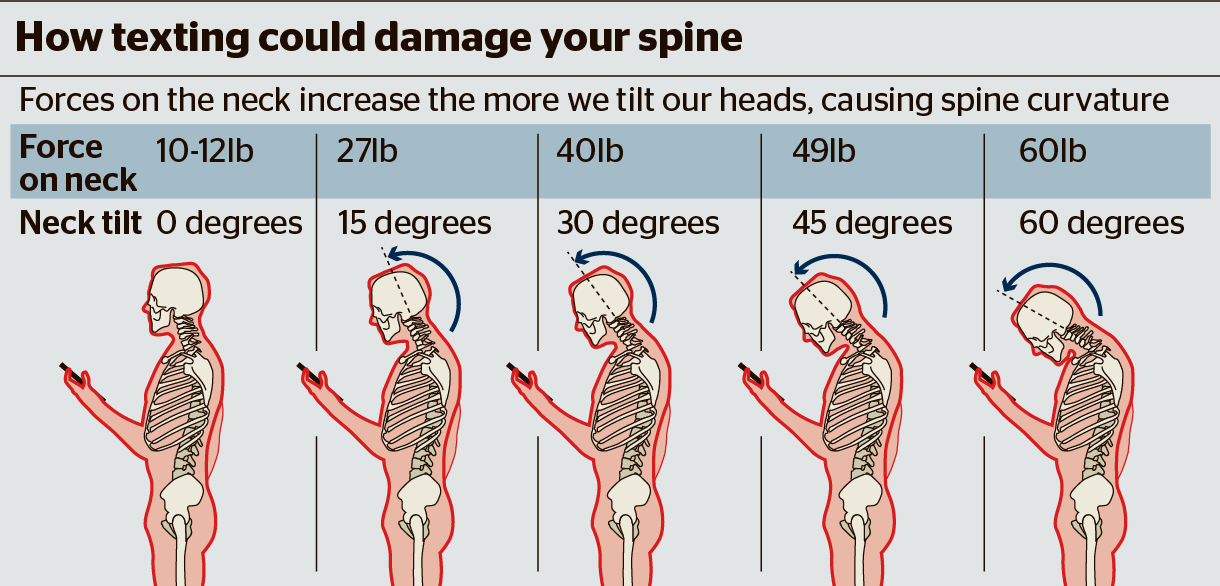 Source: Wilderman Physical Therapy