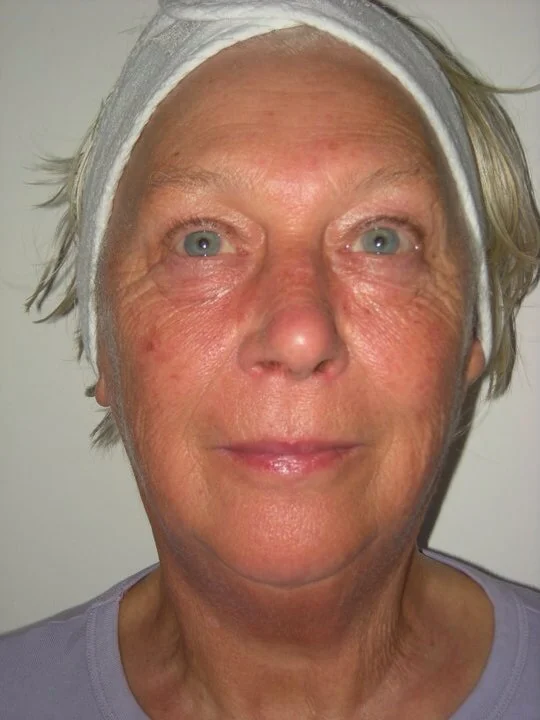 This photo was taken after treatment. 