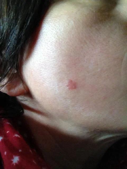 This is is the area prior to Salvestrol treatment in February 2013.