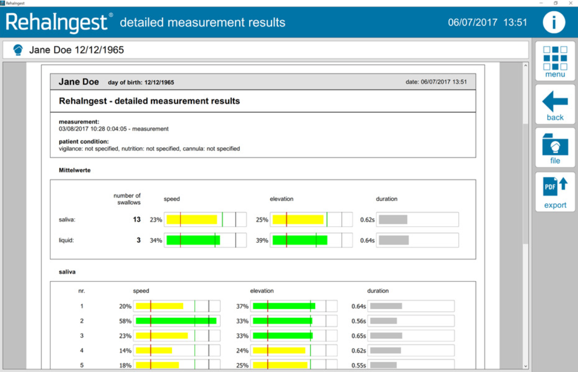 Detailed Measurement Results are available